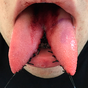 06-13-tongue-splitting_sm.jpg