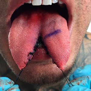 06-15-tongue-splitting_sm.jpg