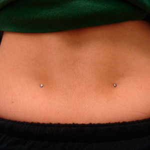 Double back microdermals