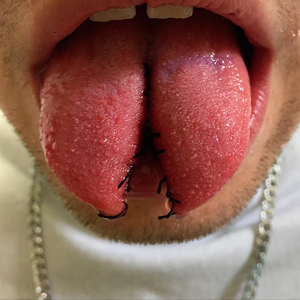06-17-tongue-splitting_sm.jpg