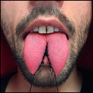 06-19-tongue-splitting_sm.jpg