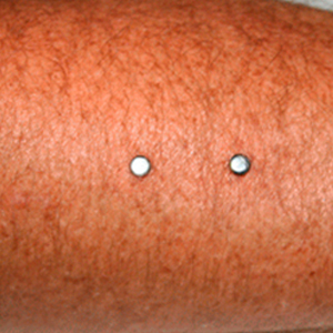 Arm surface piercing