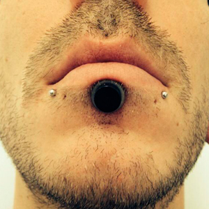 Big labret with scalpelling technique
