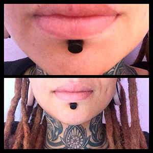 Big labret with scalpelling technique
