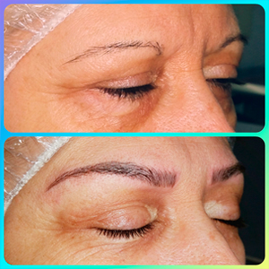 before and after hair stroke eyebrows reconstruction microblading