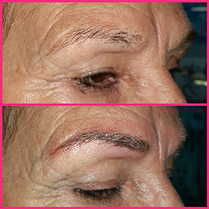 Eyebrows Microblading with Anti-Aging Effect