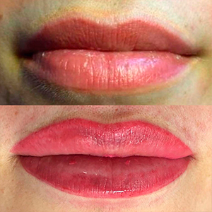 Full lip blend medium rose micropigmentation