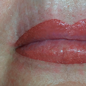 Full salmon shaded lip micropigmentation