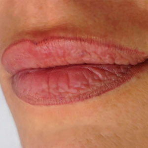 Dark Granate lips outline micropigmentation