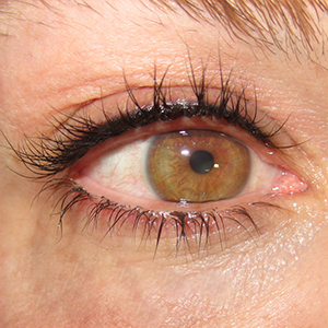 Upper eyelashes filling micropigmentation