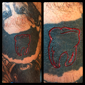 06-31-tooth-scarification-on-black-tattoo_sm.jpg