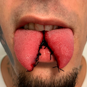 06-34-tongue-splitting_sm.jpg