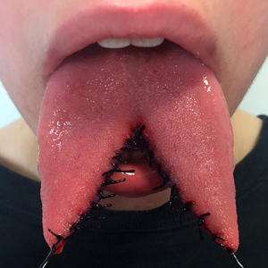 06-35-tongue-splitting_sm.jpg