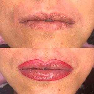 Antes y después del contorneado de labio de color rosa roja y sombreado con micropigmentación.