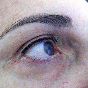 Contorno de ojos superior sin alas con micropigmentación