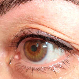 Winged eyelashes filling micropigmentation