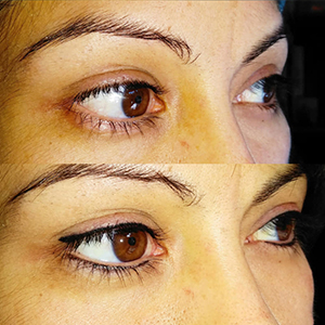 Contorno superior de ojos de alas redondeadas con micropigmentación